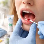 découvrez 10 conseils pratiques pour soigner efficacement une cloque de sang dans la bouche, soulager la douleur et favoriser une cicatrisation rapide.