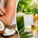 découvrez les effets secondaires possibles de la noix de coco et apprenez comment les éviter pour profiter de ses bienfaits en toute sécurité.