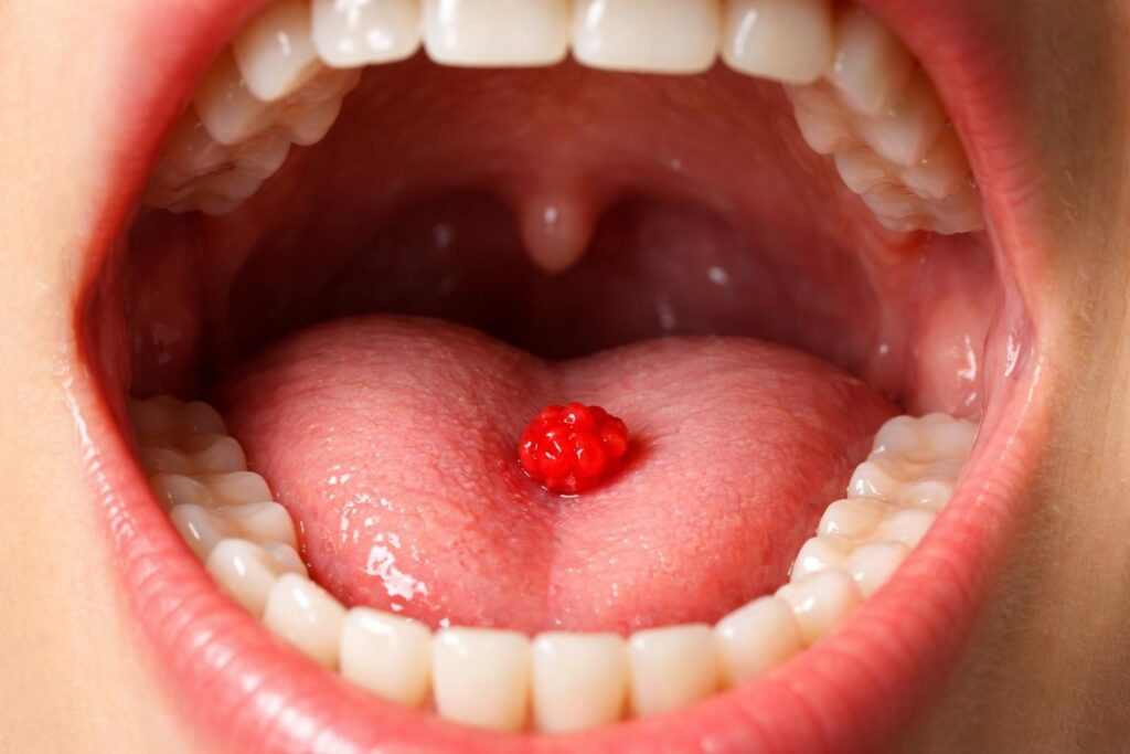 découvrez les vérités et les mythes autour des petites boules de sang dans la bouche, leurs causes possibles et quand consulter un professionnel de santé.